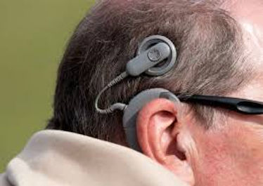 What is a Cochlear Implant and Why Might We Refer You?