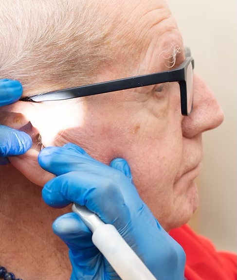 Audiologist carrying out ear wax removal
